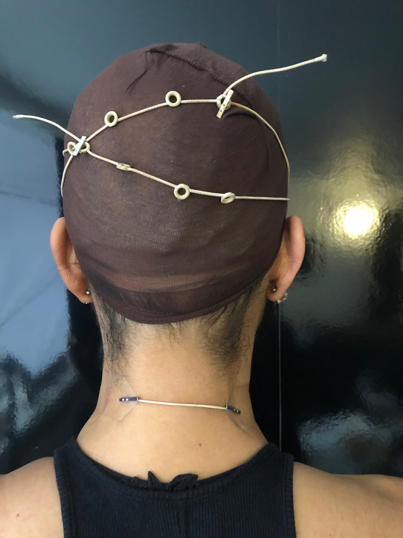 Crisscross: Face tape fastened in the back. Neck tape in place.